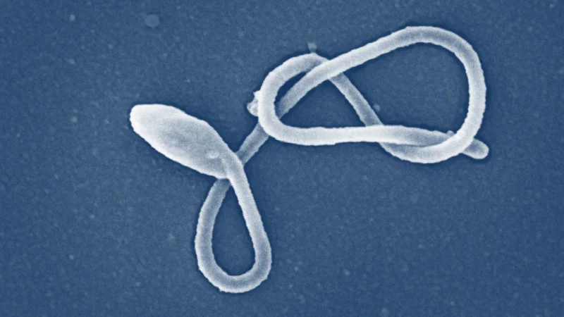 Uganda abanduye Ebola Bageze ku 9